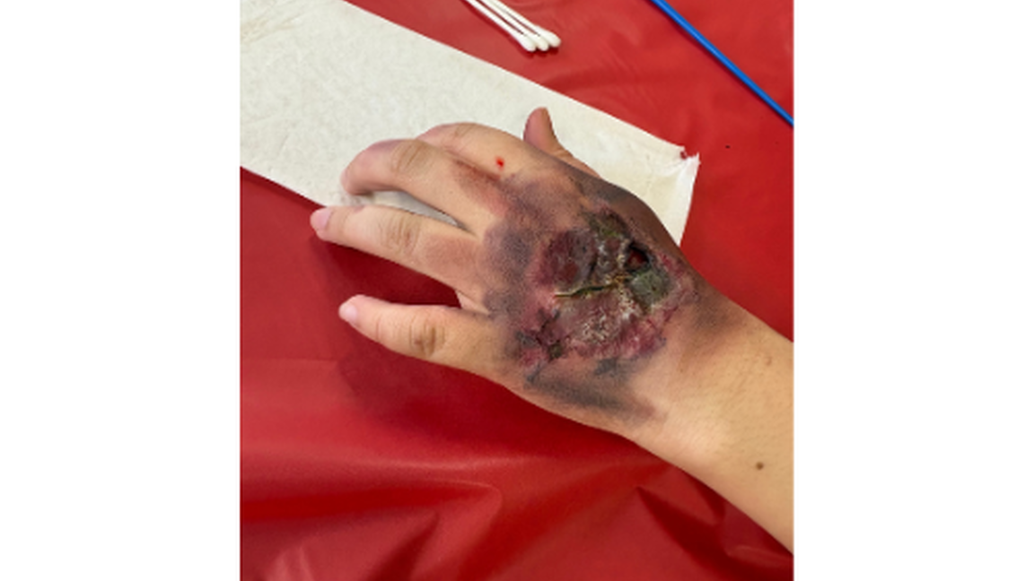 CRÉATION D'EFFETS SPÉCIAUX - ATELIER BLESSURE (12 ans et +)